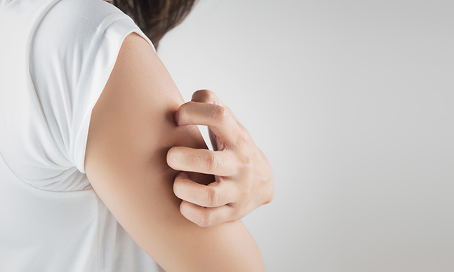 Eczema: tudo o que precisa de saber